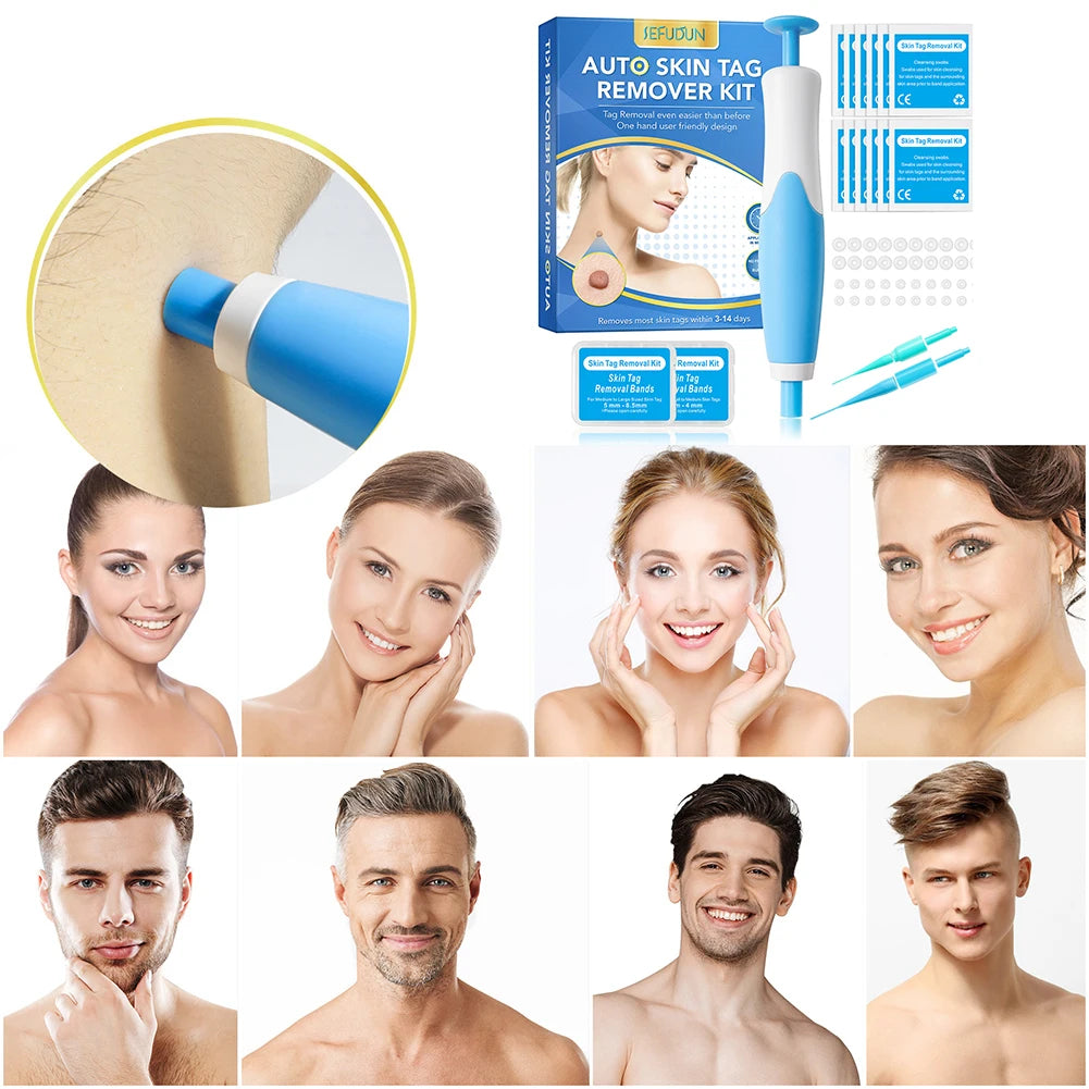 Skin Tag Removal Tool